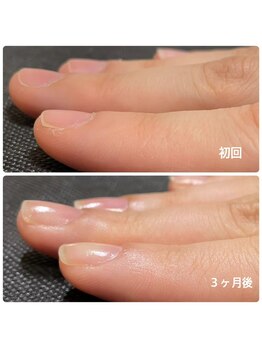 ルームイチマルイチネイルズ(Room101Nails.)/自爪育成・最強のネイルケア鳥取
