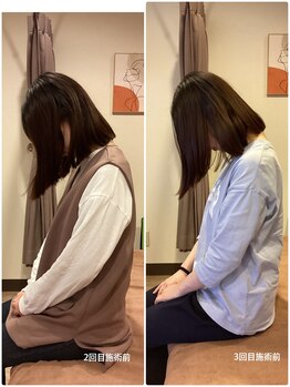 ヴィラ整骨院/首のコリや違和感にも◎