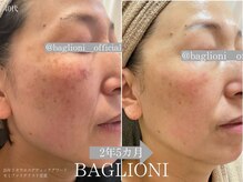 メディカルサロン バリオーニ/2025年肌改善セミファイナリスト