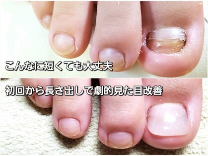 マニブルームの写真