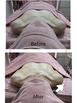 チュラ 大宮店(Chura)/肩位置激変→谷間も激変(2/4)