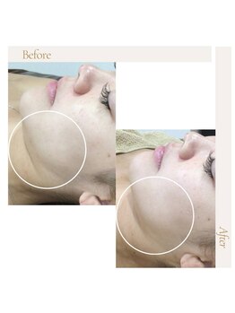 ファロンビューティー(fallon beauty)/お客様ビフォー×アフター