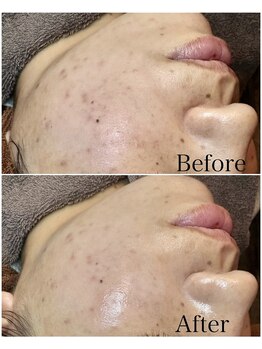 ブラックボックス(BLACK BOX)/30代女性のお客様