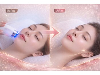 アプロ(Aphro)/1回でも効果を実感