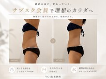 ヴォアール 東静岡店(VOIR)の雰囲気（結果重視！サブスク会員で毎月のケアをお得にサポート）