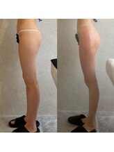 アーネスト(EARNEST)/TikTokで話題！超絶美脚に