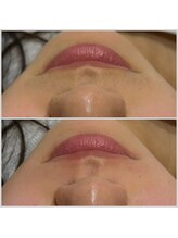 ニコット(Nicotto)/部分Wax出来ます☆