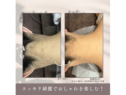 モアトゥインクル 東広島西条店(MORE twinkle)の写真