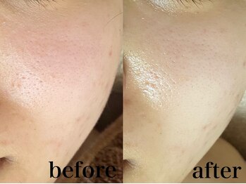 フェイシャルサロン アリイ(ALII)/