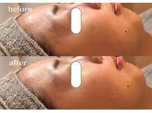 リスタ(RSTA)/【BEFORE/AFTER】