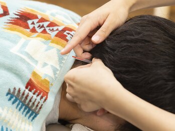 ネイビー鍼灸指圧治療院(NAVY鍼灸指圧治療院)/鍼灸メニュー!