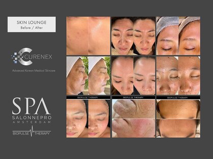 スキンラウンジ(SKIN LOUNGE)の写真