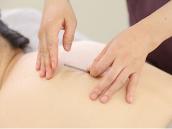 トゥルーカラーズの写真/アロマと鍼灸で不調を根本から改善◎今日だけの疲れを改善ではなく、持続性のある改善を目指します！