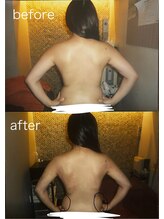 エステティックサロン ル ソイル(Le seuil)/お客様ビフォーアフター♪