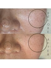 コルザフラワー(charroux flower)/シミケア