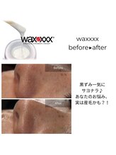 ロア ビューテ(loa beaut'e)/waxxxxでむき卵肌に♪