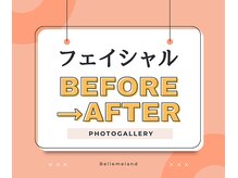 浜松富塚ベルミーランド/フェイシャルBEFORE→AFTER