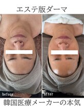 リリー(LILY)/韓国で大人気！