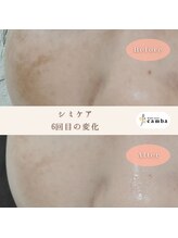 カンバ(camba)/【シミケア】Before→after