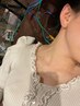 【美容鍼灸】【美顔鍼と一緒に首肩コリ改善】美顔鍼+首肩施術セット 60分