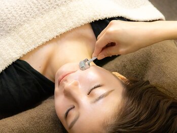 ボニー(Bonnie)の写真/《初めての方にも◎》刺さない美容鍼＋小顔矯正でやさしく整える♪むくみ・フェイスラインケアに