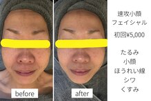 ほねつぎ一休さん 宇品店