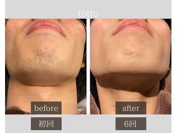 サロントット(salon totto)/before→after