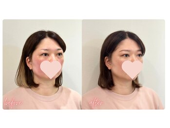 スタイルキューピット(style cupit)/メイクビフォアフター＊30代