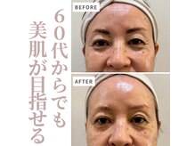 アプリコット(Apricot)の雰囲気（マシン×技術で進化系リフトアップ体験）