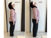 ラポール アンド スムース(rapport and smooth)/ビフォーアフター