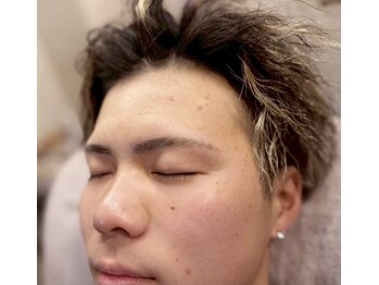 スリーピース(3Peace)/アーチ眉 Before/After