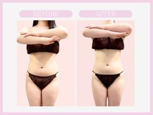 スリムライン 八戸店(The Slim Line)/before→after