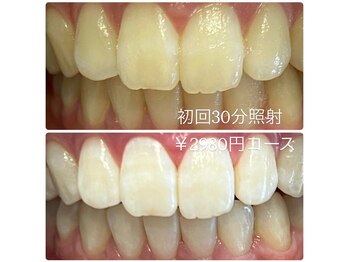 ホワイトニングルーム 横浜店(Whitening Room)/ホワイトニング/横浜