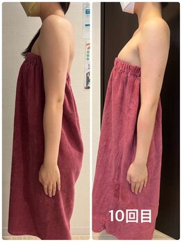 ロココ 豊田店(Rococo)/ビフォーアフター