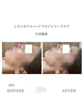 サロンエイトミー 西船橋店(salon 83)/【レモンボトル】before→after