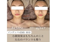 セルフィット 恵比寿店(cellfit)の雰囲気（恵比寿インディバ｜フェイスライン・むくみケア）