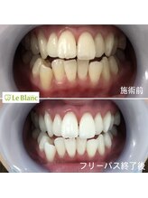 ルブラン 奈良店(Le Blanc)/日々の着色や汚れを撃退！