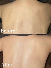 ジョエルワックス 沖縄那覇店(JOELLE WAX)/意外と背中の毛見られています、