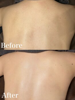 ジョエルワックス 沖縄那覇店(JOELLE WAX)/意外と背中の毛見られています、