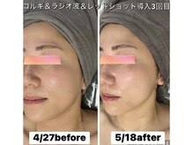 サロン ド ジジ(SALON DE GiGi)の雰囲気（デトックス＆巡りケアは健康＆美容、身体＆お肌に良い事尽くし◎）