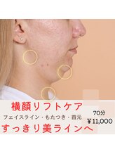 ミモザ(mimosa)/横顔リフト◎すっきり美ライン