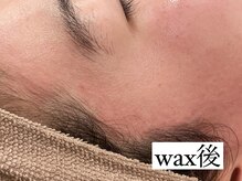 サロン ド ワカ(Salon de WAKA)/フェイシャルwax初回　施術後