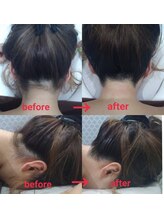 メルシー レディースアンドメンズサロン(Merci)/うなじ美人脱毛