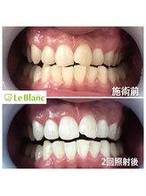 ルブラン 奈良店(Le Blanc)/男性のお客様も通いやすい！