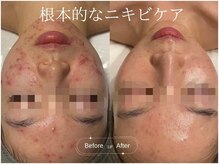 サロンドシー(SALON DE C)/カスタムする事で最短肌質改善！