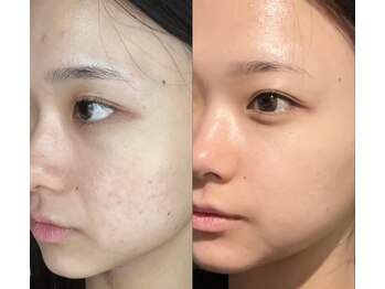 ジョワ 黒崎店(joie)/