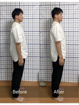 幸鍼灸整体院 武庫之荘院/整体・トレーニング・姿勢変化18