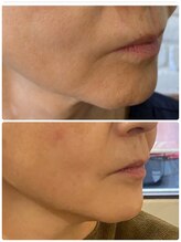 オリエンス(oriens)/トリプルショット