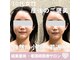 小顔たるみ毛穴専門看護師 クリニカルサロン Rio【3月上旬OPEN（予定）】の写真
