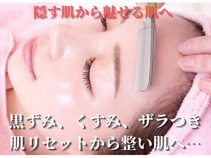 エオナ(EONA)の写真